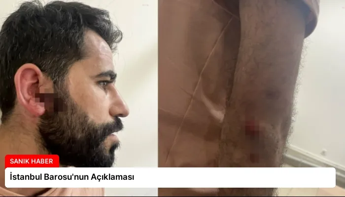 İstanbul Barosu’nun Açıklaması