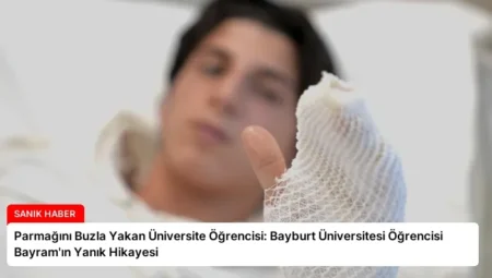 Parmağını Buzla Yakan Üniversite Öğrencisi: Bayburt Üniversitesi Öğrencisi Bayram’ın Yanık Hikayesi